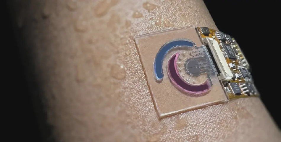 Wearable microfluidic sweat sensor